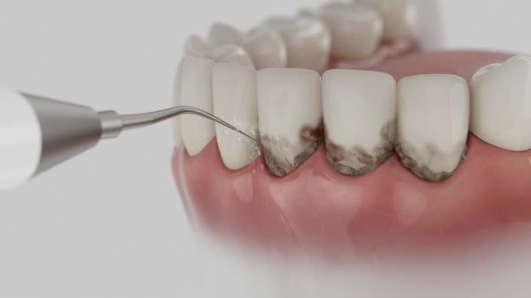 Reliable Dental Implants contractor in Leonard, TX by Smile Center Dentistry